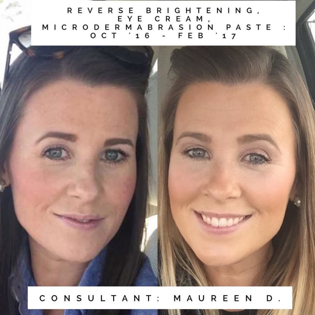 rodan and fields spotless before and after